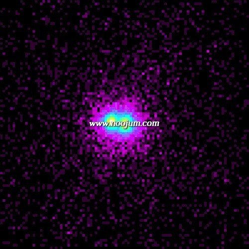 m15_xraymed.jpg